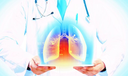 Doctor Showing Graphic of Lungs